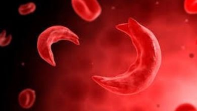 सिकलसेल एनिमिया